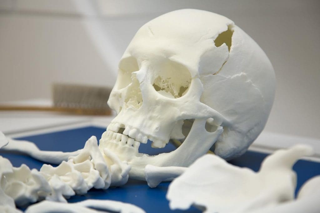 human skull at the King Richard III Visitor Centre Leicester